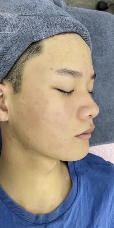 Trước